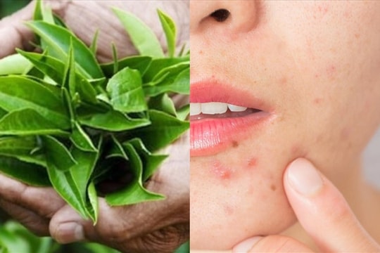 Vì sao trà xanh có tác dụng làm đẹp da?