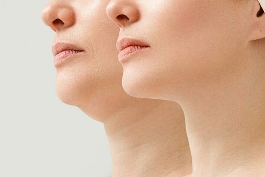 Bài tập giúp bạn thoát tình trạng cằm đôi khó chịu