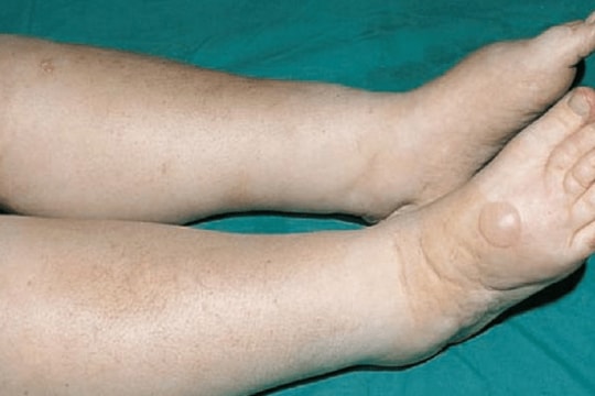 Người đàn ông trẻ vội vào viện cấp cứu vì trót cãi lời bác sĩ