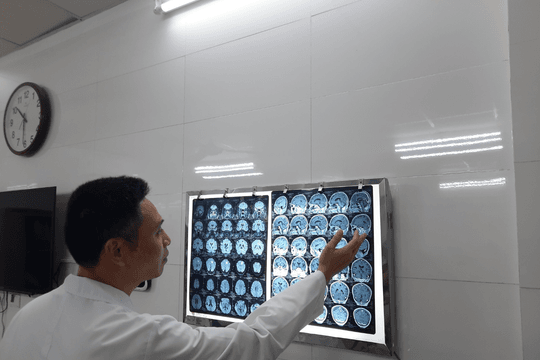Não bộ tổn thương nặng nề của cựu chủ tịch xã món “đặc sản”