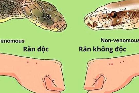 Bệnh viện Bạch Mai tiếp nhận nhiều ca bị rắn cắn trong bão Yagi