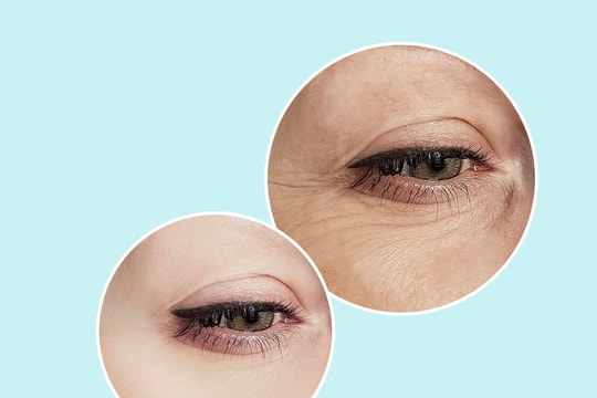 Thói quen cần từ bỏ để giảm thiểu nếp nhăn dưới mắt