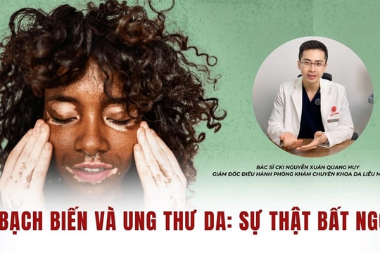 Bạch biến và ung thư da: sự thật bất ngờ