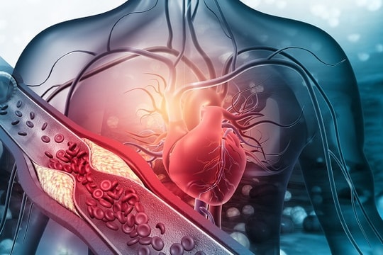 Bí quyết giảm cholesterol bằng chế độ ăn uống hiệu quả
