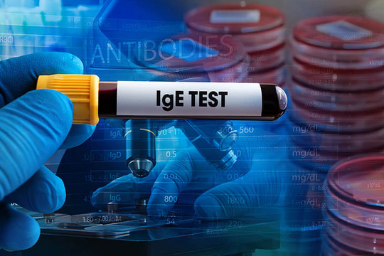 Nguyên nhân và cách xử lý sốc phản vệ