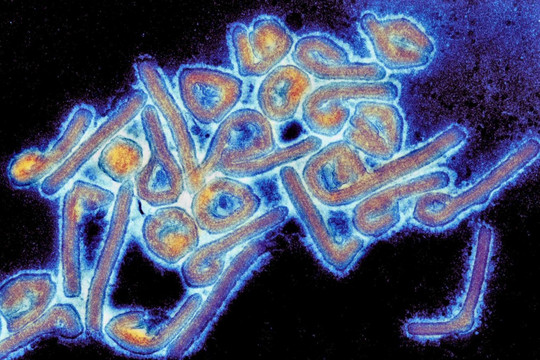 Virus Marburg: Mối nguy hiểm mới đối với sức khỏe toàn cầu