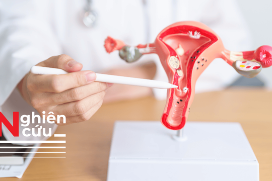 Phương pháp điều trị ung thư cổ tử cung mới giúp giảm nguy cơ tử vong