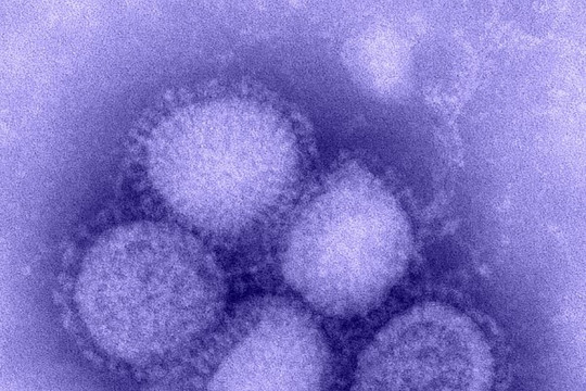Bộ Y tế thông tin về virus A/H1pdm sau ca tử vong ở Bình Định