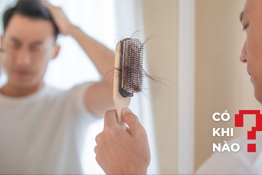 Có khi nào bổ sung testosterone cũng có thể gây rụng tóc