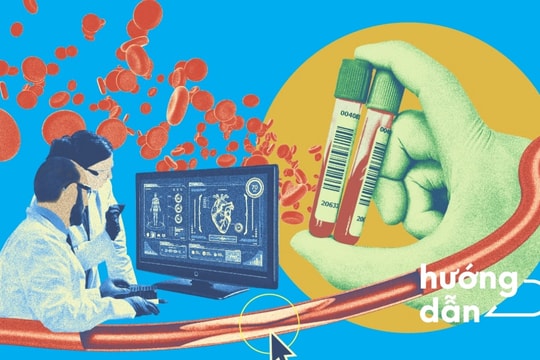 2 xét nghiệm quan trọng đối với tim mạch có thể bạn chưa biết đến