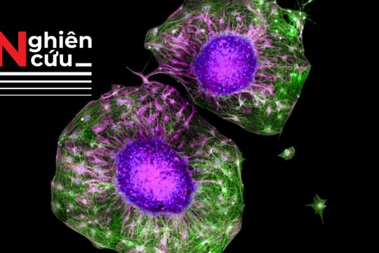 Nghiên cứu mới chỉ ra việc tập luyện cơ bắp giúp tế bào thần kinh phát triển