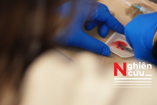 Độc đáo: Covid-19 làm kích hoạt cơ chế miễn dịch giúp thu nhỏ khối u ung thư