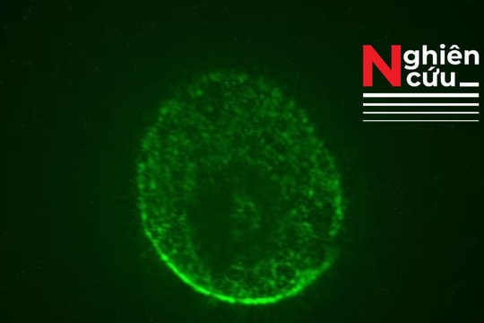 Như phim viễn tưởng: Nuôi cấy não người trên trạm vũ trụ nhằm tìm phương pháp điều trị mới