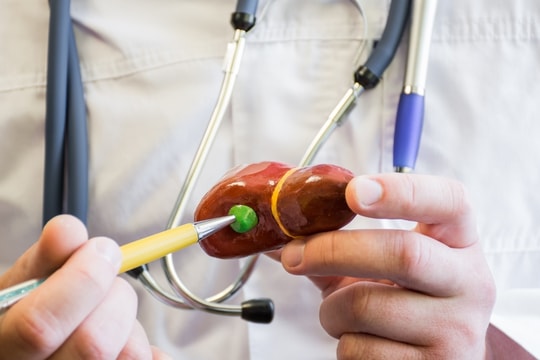 Ung thư túi mật đang gia tăng đến hơn 85% ở người trẻ