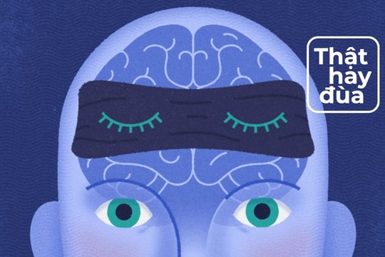 Điều gì sẽ xảy ra nếu bạn không thể tưởng tượng được hình ảnh trong đầu?