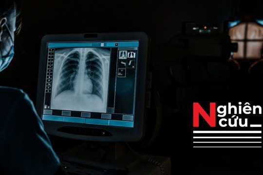 Hàng triệu người có nguy cơ mất xương từ một loại thuốc phổ biến