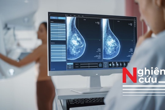 Một số dạng ung thư vú giai đoạn rất sớm có thể không cần điều trị