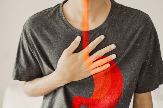 Nguyên nhân trào ngược dạ dày là gì?