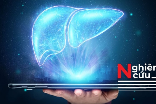 13% trường hợp sa sút trí tuệ thật ra là bệnh não gan và có thể điều trị được