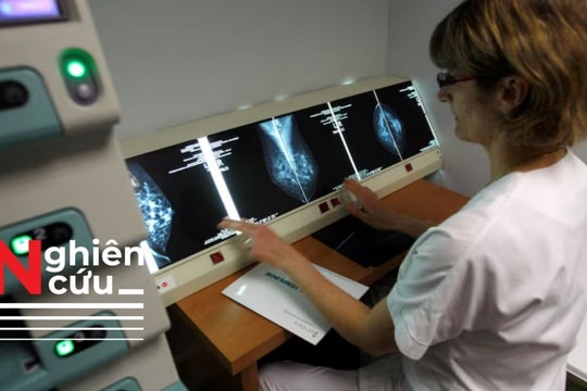 Phát hiện 7.000 đột biến khác nhau nằm trong gen tiềm ẩn gây ung thư BRCA2