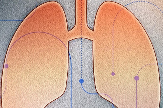 5 dấu hiệu ung thư phổi dù cho không hút thuốc vẫn nên biết!