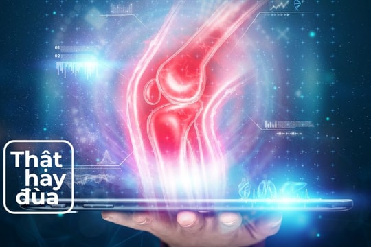 5 hiểu lầm phổ biến về viêm khớp đã được khoa học làm rõ