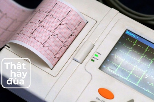 Chúng ta có thể sắp tự đo được điện tâm đồ tại nhà?