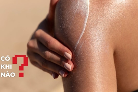 Khám phá mới: RNA mới là thủ phạm gây ra cháy nắng?