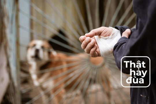 Bệnh dại có thể 'âm thầm' tồn tại bao nhiêu năm kể từ khi bị cắn?