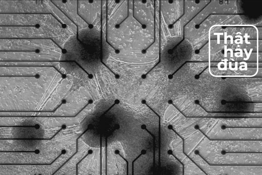 Máy tính sinh học chạy bằng tế bào não người đầu tiên trên thế giới