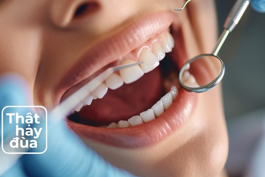 Chăm sóc răng miệng kém có thể âm thầm gây hại cho... trái tim