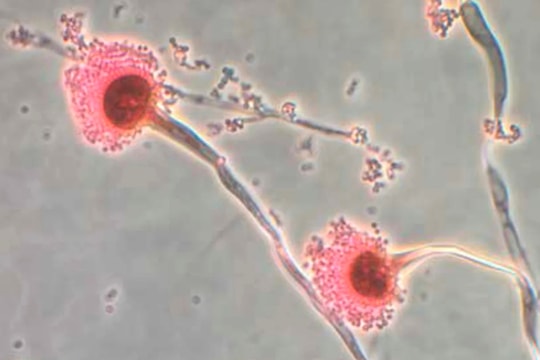 Loài nấm mới có thể "ăn cơ thể từ trong ra ngoài" đang lan rộng khi Trái Đất nóng lên