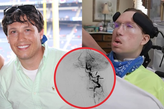 Cảnh báo: Liệt vĩnh viễn sau khi nắn cổ tại phòng khám xương khớp