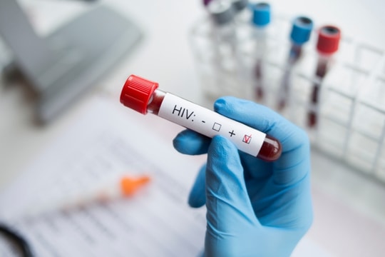 WHO khuyến nghị các quốc gia tiêm ngừa HIV hai lần mỗi năm