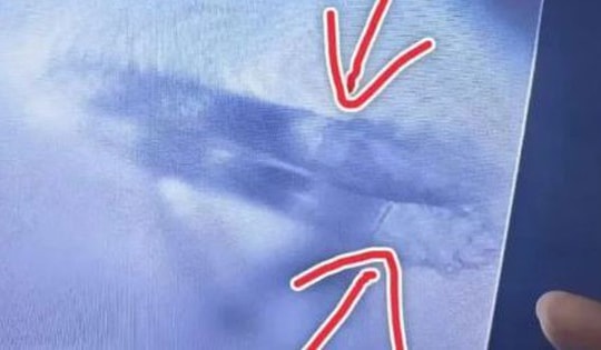 Khám mắt cho người phụ nữ, bác sĩ sốc nặng khi phát hiện điều đáng sợ