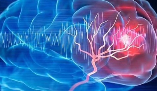 Người phụ nữ 57 tuổi bất ngờ phát hiện khối u não nhờ đồng hồ đeo tay