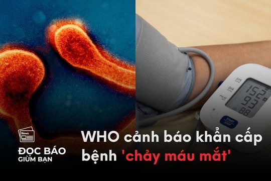 4/9/2025 | WHO cảnh báo khẩn cấp bệnh 'chảy máu mắt'. Kiểu tính cách dễ bị tăng huyết áp