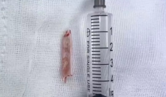 Chụp CT cho người phụ nữ, bác sĩ phát hiện ra "bí mật" đáng sợ