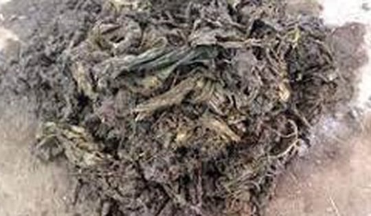 Các bác sĩ sốc nặng khi lấy ra thứ "đáng sợ" nặng 40 kg từ dạ dày con bò hoang