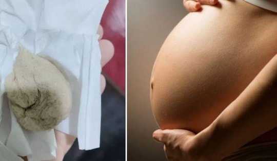 Đau vùng kín suốt 1 tháng sau sinh,người phụ nữ sốc nặng khi phát hiện "vật lạ" trong cơ thể