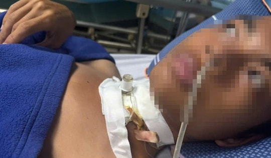 Cứu sống nam thanh niên bị đứt khí quản do vướng phải dây điện