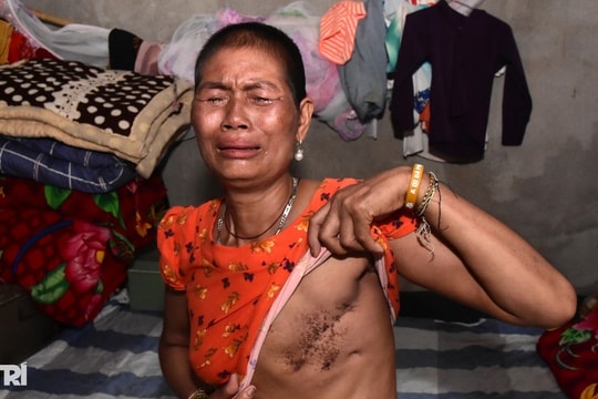 Người phụ nữ góa bụa mắc 2 bệnh nan y mong được cứu giúp