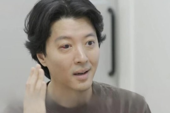 Gương mặt Lee Dong Gun biến dạng gây lo lắng