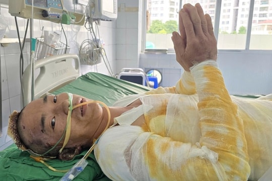 Người bố trẻ dân tộc Mông bỏng 64% cơ thể chắp tay khẩn cầu: “Xin cứu em!”