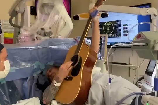 Chơi guitar trong lúc mổ não