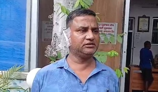 Cãi nhau, người phụ nữ đánh rồi cắn đứt tai chồng