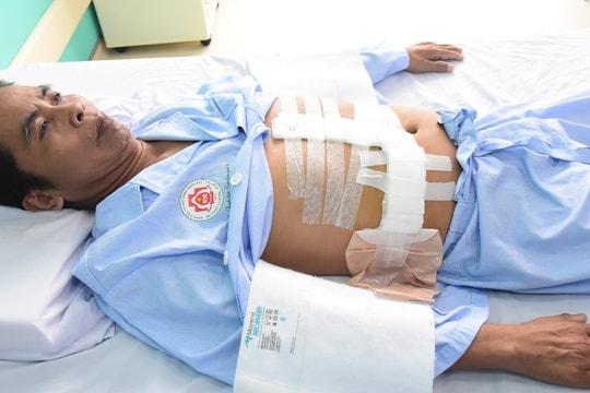 Sinh viên nghèo hiến gan cứu cha, nguy cơ dang dở việc học