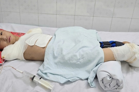 Đau nhói lòng cảnh cậu bé bị dòng điện cao thế cướp đi tương lai