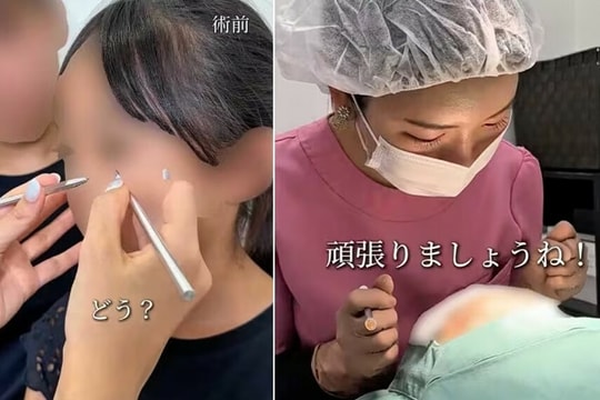 Thẩm mỹ viện gây tranh cãi vì 'dao kéo' cho bé gái 10 tuổi