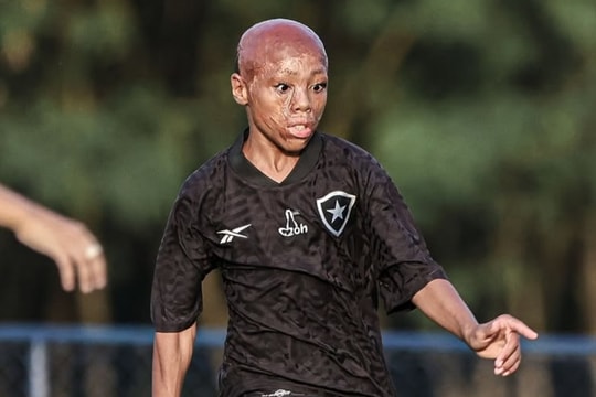 Tài năng mới của Brazil từng suýt chết bỏng